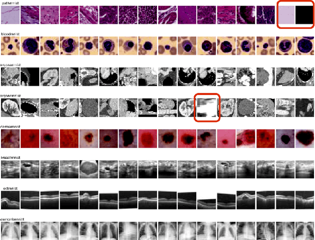Figure 1 for Efficient Data-Sketches and Fine-Tuning for Early Detection of Distributional Drift in Medical Imaging