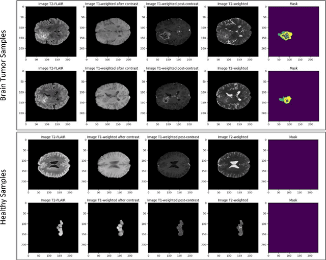Figure 3 for Residual Vision Transformer (ResViT) Based Self-Supervised Learning Model for Brain Tumor Classification