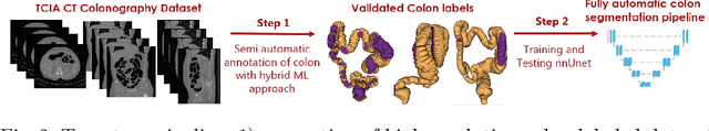 Figure 3 for HQColon: A Hybrid Interactive Machine Learning Pipeline for High Quality Colon Labeling and Segmentation