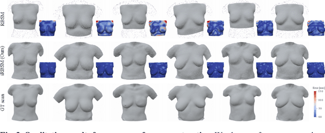 Figure 2 for iRBSM: A Deep Implicit 3D Breast Shape Model
