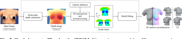 Figure 4 for iRBSM: A Deep Implicit 3D Breast Shape Model