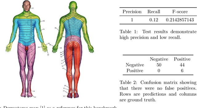 Figure 1 for Causal-Discovery Performance of ChatGPT in the context of Neuropathic Pain Diagnosis