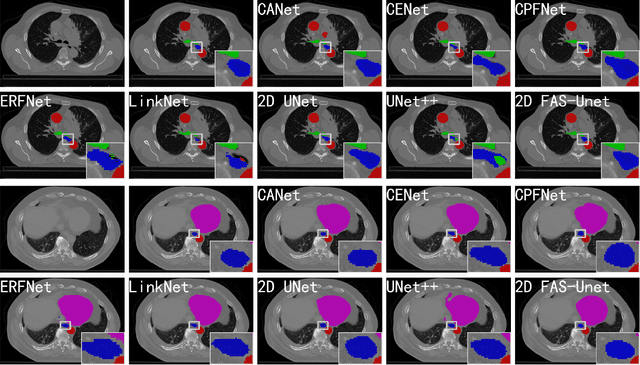 Figure 3 for FAS-UNet: A Novel FAS-driven Unet to Learn Variational Image Segmentation