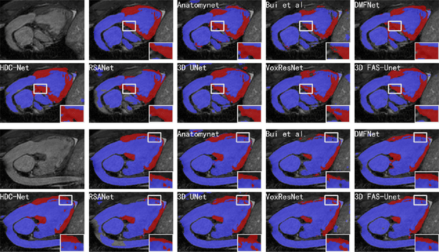 Figure 4 for FAS-UNet: A Novel FAS-driven Unet to Learn Variational Image Segmentation