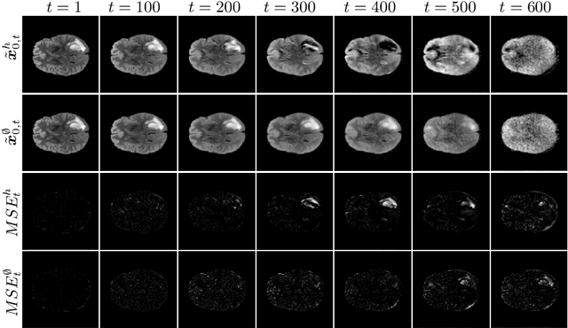 Figure 3 for AnoFPDM: Anomaly Segmentation with Forward Process of Diffusion Models for Brain MRI