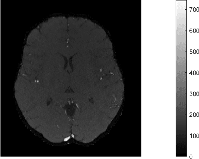 Figure 1 for High-Dimensional Confidence Regions in Sparse MRI