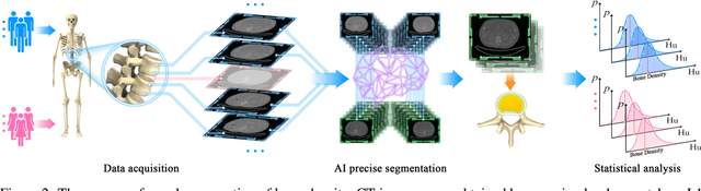 Figure 4 for The changing rule of human bone density with aging based on a novel definition and mensuration of bone density with computed tomography