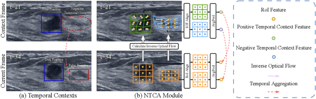 Figure 1 for Mining Negative Temporal Contexts For False Positive Suppression In Real-Time Ultrasound Lesion Detection