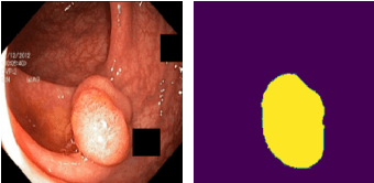 Figure 3 for Meta-Polyp: a baseline for efficient Polyp segmentation