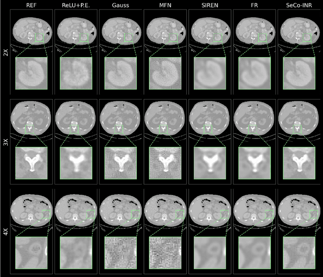 Figure 3 for SeCo-INR: Semantically Conditioned Implicit Neural Representations for Improved Medical Image Super-Resolution