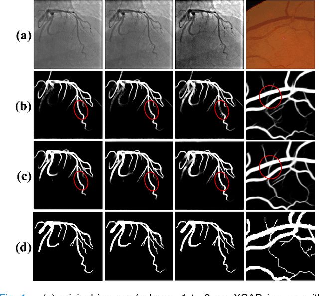 Figure 1 for Affinity Feature Strengthening for Accurate, Complete and Robust Vessel Segmentation