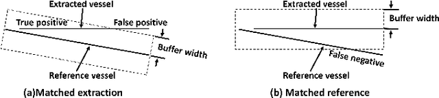 Figure 2 for Affinity Feature Strengthening for Accurate, Complete and Robust Vessel Segmentation