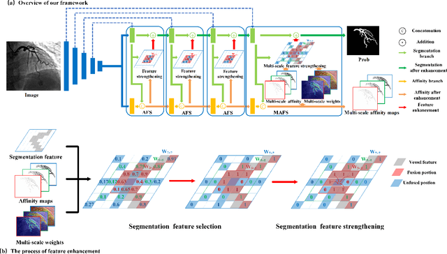 Figure 4 for Affinity Feature Strengthening for Accurate, Complete and Robust Vessel Segmentation
