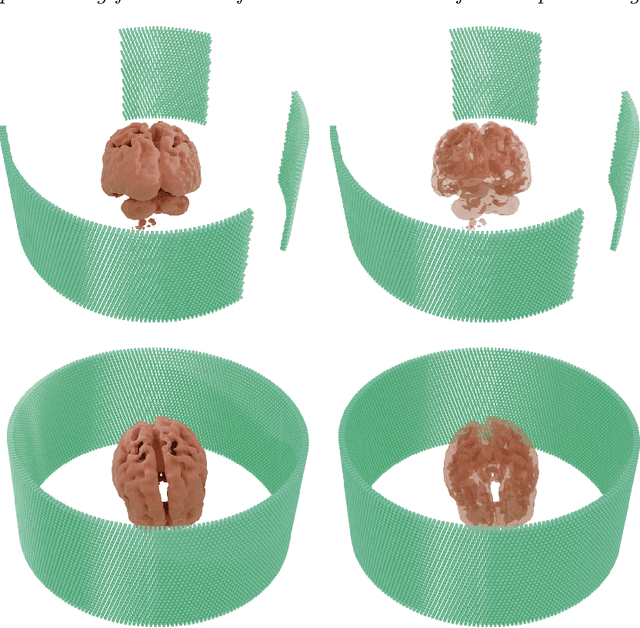 Figure 3 for The study of non-complete-ring positron emission tomography (PET) detection method
