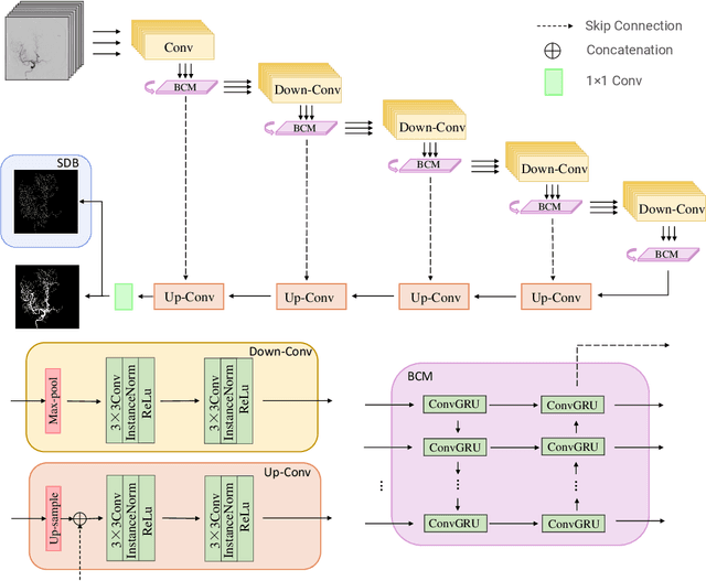Figure 2 for TSI-Net: A Timing Sequence Image Segmentation Network for Intracranial Artery Segmentation in Digital Subtraction Angiography