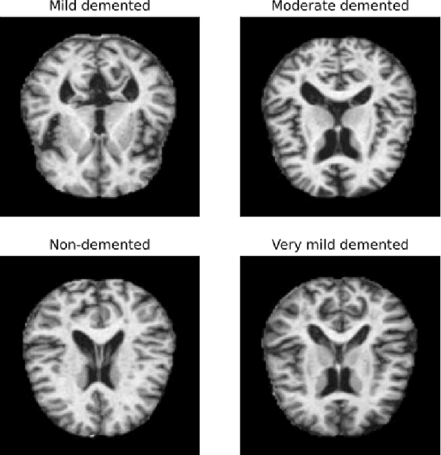 Figure 1 for Metric Privacy in Federated Learning for Medical Imaging: Improving Convergence and Preventing Client Inference Attacks