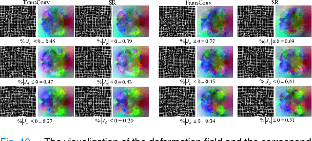 Figure 2 for UTSRMorph: A Unified Transformer and Superresolution Network for Unsupervised Medical Image Registration