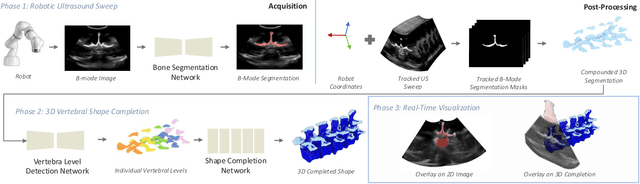Figure 2 for Shape Completion and Real-Time Visualization in Robotic Ultrasound Spine Acquisitions