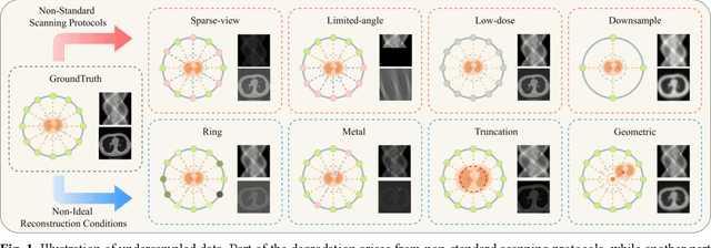 Figure 1 for UniSino: Physics-Driven Foundational Model for Universal CT Sinogram Standardization