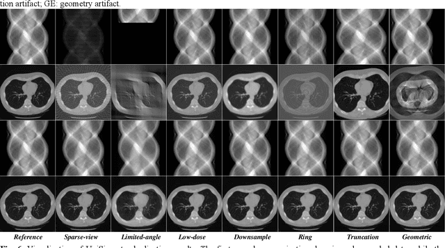 Figure 4 for UniSino: Physics-Driven Foundational Model for Universal CT Sinogram Standardization