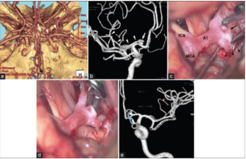 Figure 3 for Medical Vision-Language Pre-Training for Brain Abnormalities