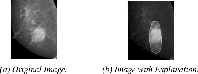 Figure 3 for Transferring Domain Knowledge with (X)AI-Based Learning Systems