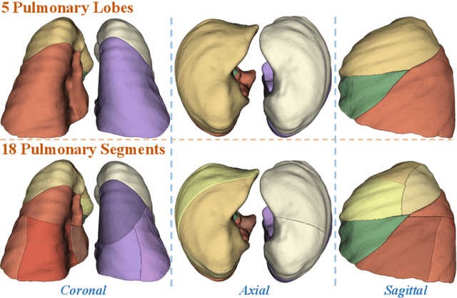 Figure 1 for Template-Guided Reconstruction of Pulmonary Segments with Neural Implicit Functions