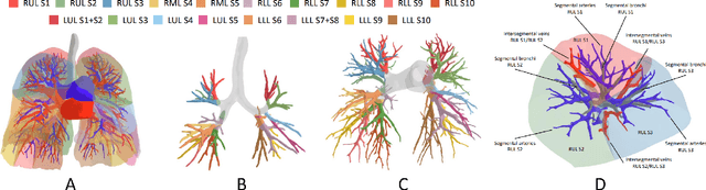 Figure 3 for Template-Guided Reconstruction of Pulmonary Segments with Neural Implicit Functions