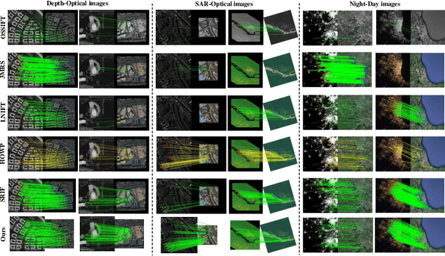 Figure 4 for REMM:Rotation-Equivariant Framework for End-to-End Multimodal Image Matching
