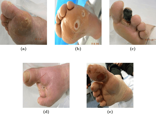 Figure 3 for UlcerGPT: A Multimodal Approach Leveraging Large Language and Vision Models for Diabetic Foot Ulcer Image Transcription