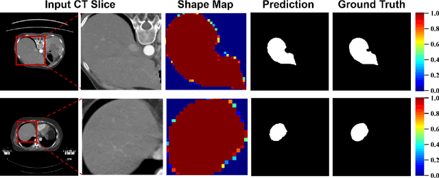 Figure 3 for Mixture-of-Shape-Experts (MoSE): End-to-End Shape Dictionary Framework to Prompt SAM for Generalizable Medical Segmentation