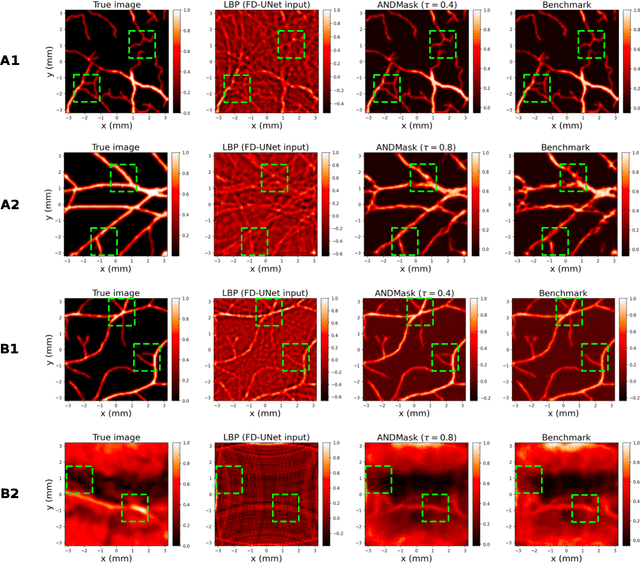 Figure 2 for Invariant Representations in Deep Learning for Optoacoustic Imaging
