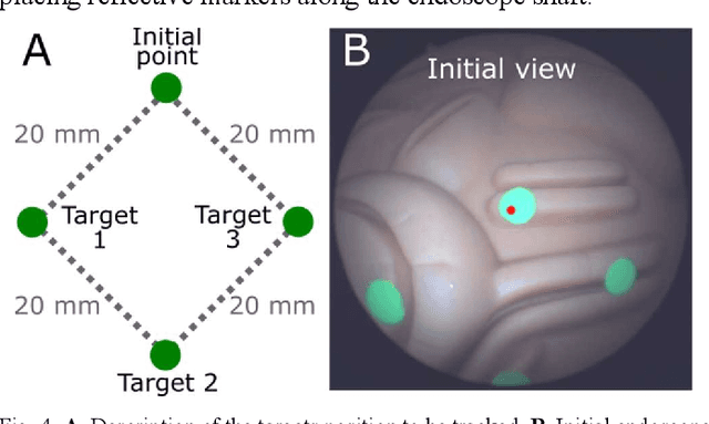 Figure 4 for Constrained Motion Planning for a Robotic Endoscope Holder based on Hierarchical Quadratic Programming