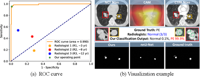 Figure 4 for Cross-Phase Mutual Learning Framework for Pulmonary Embolism Identification on Non-Contrast CT Scans
