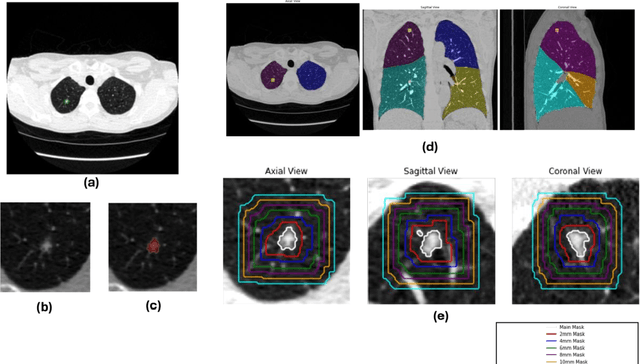 Figure 2 for Peritumoral Expansion Radiomics for Improved Lung Cancer Classification