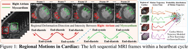 Figure 1 for Bidirectional Recurrence for Cardiac Motion Tracking with Gaussian Process Latent Coding