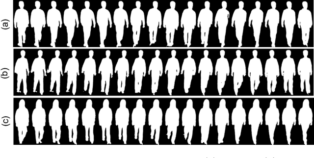 Figure 3 for Gait Patterns as Biomarkers: A Video-Based Approach for Classifying Scoliosis