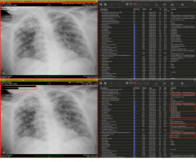 Figure 1 for Medical Image De-Identification Benchmark Challenge