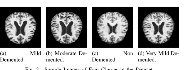 Figure 2 for Identifying Alzheimer Disease Dementia Levels Using Machine Learning Methods