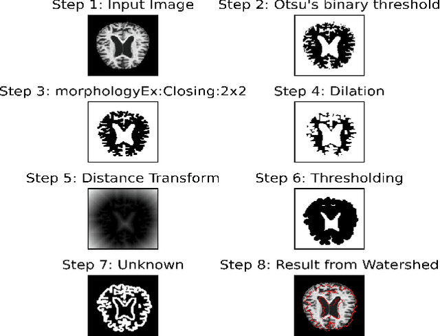 Figure 3 for Identifying Alzheimer Disease Dementia Levels Using Machine Learning Methods