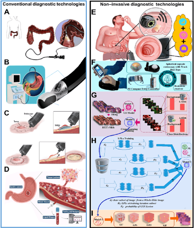 Figure 1 for An Integrated AI-Enabled System Using One Class Twin Cross Learning (OCT-X) for Early Gastric Cancer Detection