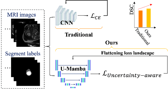 Figure 1 for UU-Mamba: Uncertainty-aware U-Mamba for Cardiac Image Segmentation