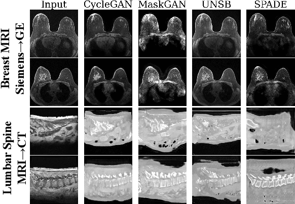 Figure 1 for Rethinking Perceptual Metrics for Medical Image Translation
