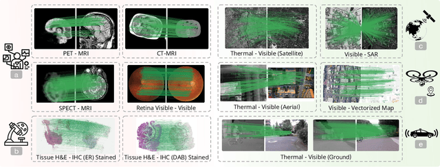 Figure 1 for MatchAnything: Universal Cross-Modality Image Matching with Large-Scale Pre-Training