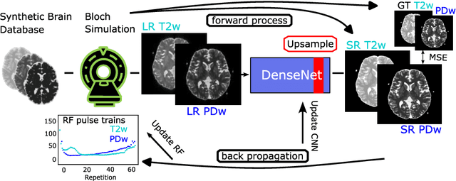 Figure 1 for Joint MR sequence optimization beats pure neural network approaches for spin-echo MRI super-resolution