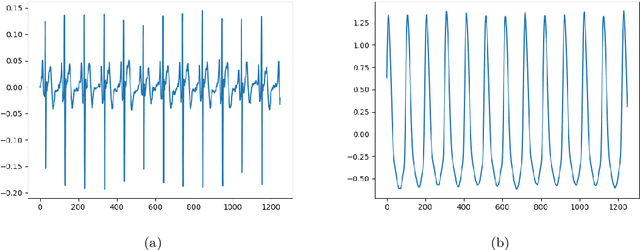 Figure 1 for BP-DeepONet: A new method for cuffless blood pressure estimation using the physcis-informed DeepONet