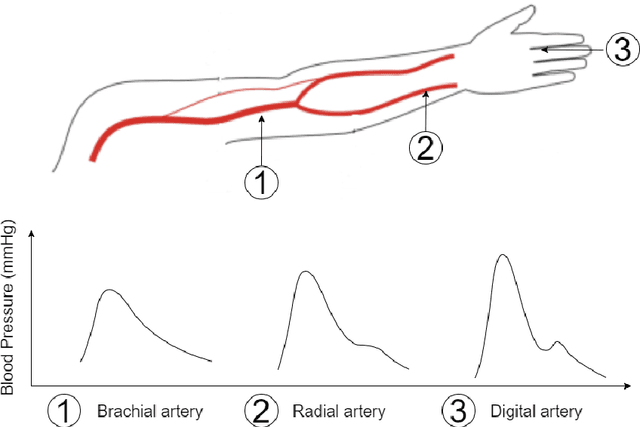 Figure 3 for BP-DeepONet: A new method for cuffless blood pressure estimation using the physcis-informed DeepONet