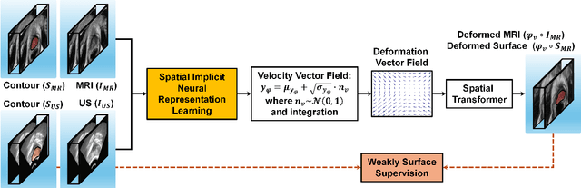 Figure 1 for Weakly Supervised Spatial Implicit Neural Representation Learning for 3D MRI-Ultrasound Deformable Image Registration in HDR Prostate Brachytherapy