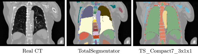 Figure 1 for Deep Learning-Based Cross-Anatomy CT Synthesis Using Adapted nnResU-Net with Anatomical Feature Prioritized Loss