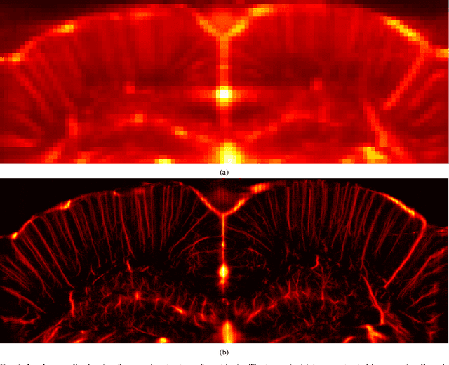 Figure 3 for Learning Super-Resolution Ultrasound Localization Microscopy from Radio-Frequency Data